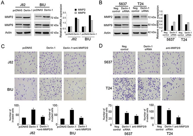 Derlin-1 regulates bladder invasion through MMP-2/9.