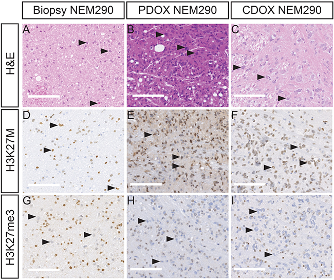 PDOX and CDOX NEM290 models display DIPG hallmarks.