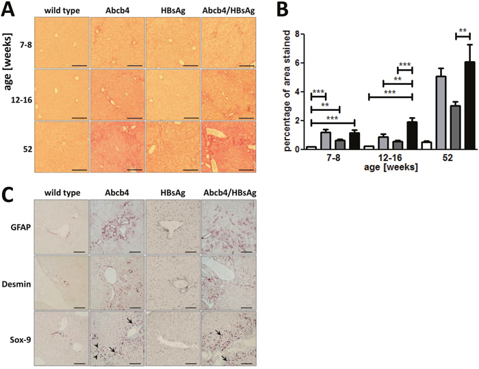Hepatic fibrosis is elevated in Abcb4-/-/HBsAg+/- mice.