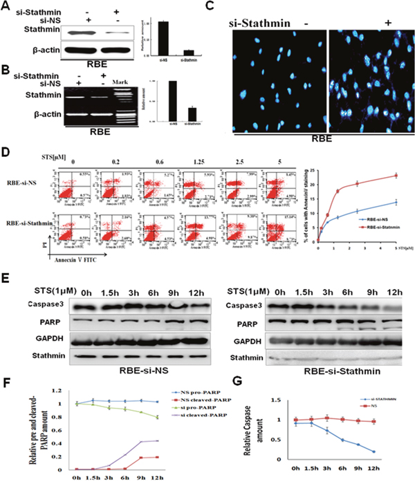 Stathmin decreased cholangiocarcinoma cell sensitivity to staurosporine.