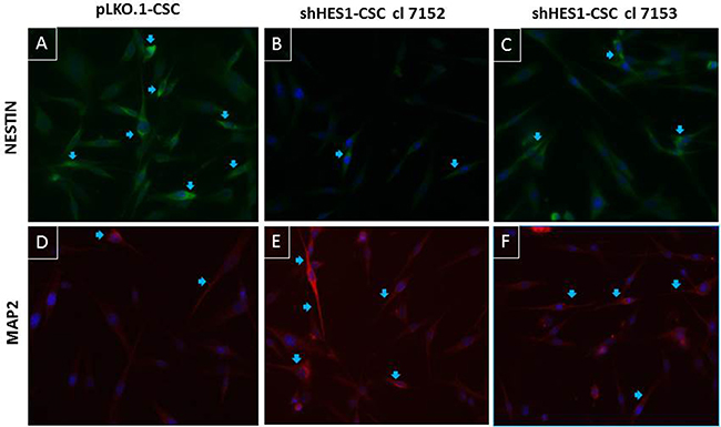 Modulation of neural differentiation in shHes1-CSC by immunofluorescence assay.