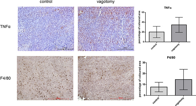 Vagotomy increased TNF&#x03B1; in pancreatic cancer tissue.