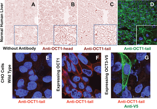 Representative images of immunohistochemical analysis of OCT1 in healthy human liver using no primary antibody (negative control).