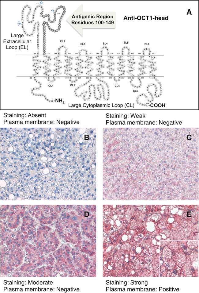 Schematic drawing of OCT1 showing the antigenic region used to raise the rabbit polyclonal LS-C31870 anti-OCT1-head antibody.