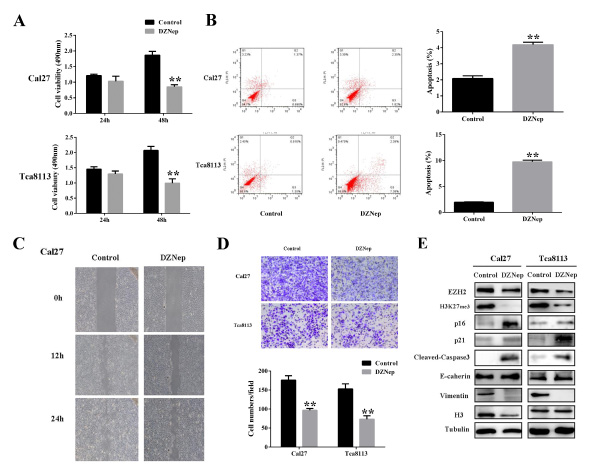 Fig 3: DZNep inhibits cell growth and migration and invasion, while induces cell apoptosis in tongue cancer cells.