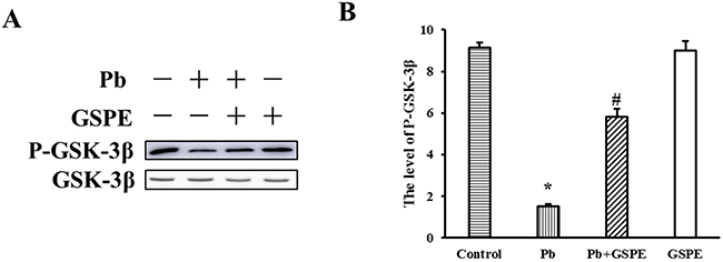 Effect of GSPE on the level of P-GSK-3&#x03B2; in Pb-induced nephrotoxicity.