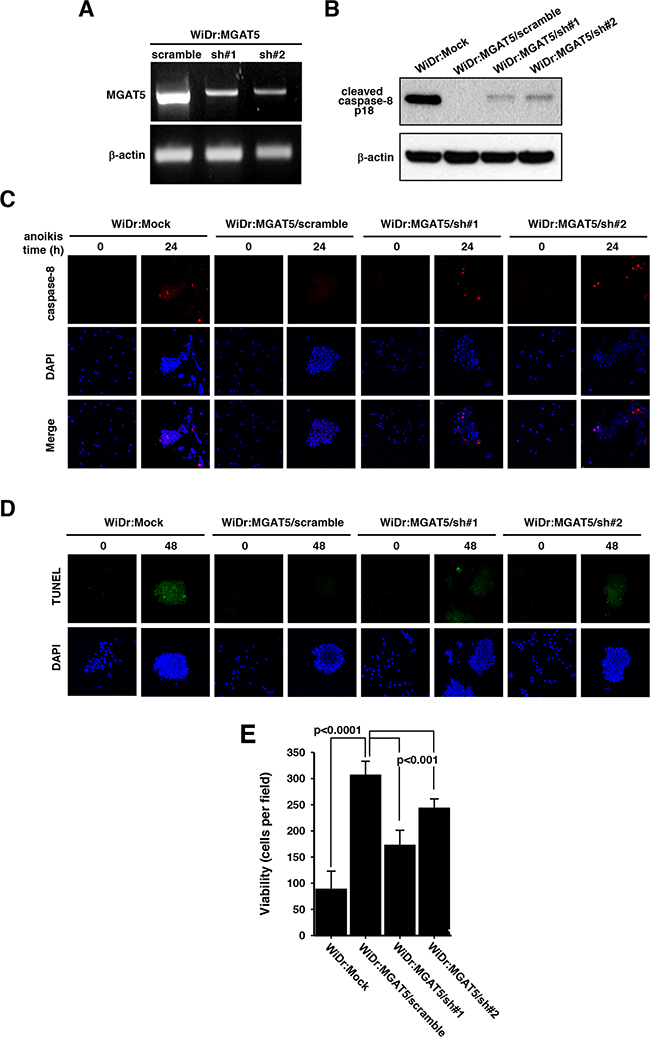 Sensitization of anoikis by suppressed MGAT5 expression.