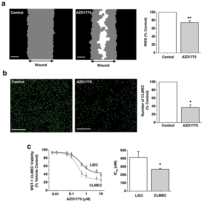 Small-molecule inhibition of WEE1 has preferential effect on CLMECs.