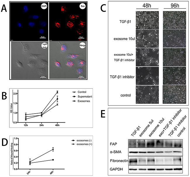 Exosomes promote HMrSV5 cells transition into CAFs by proliferation in vitro.