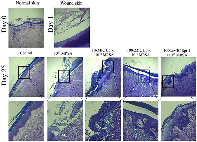 Epi-1 increases the recruitment of leukocytes near the injury region to accelerate wound healing.