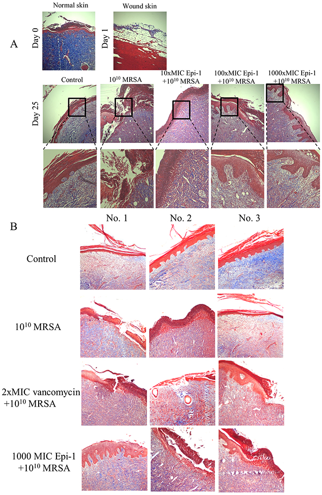 Epi-1 enhances the formation of collagen structures at the healing wound site.