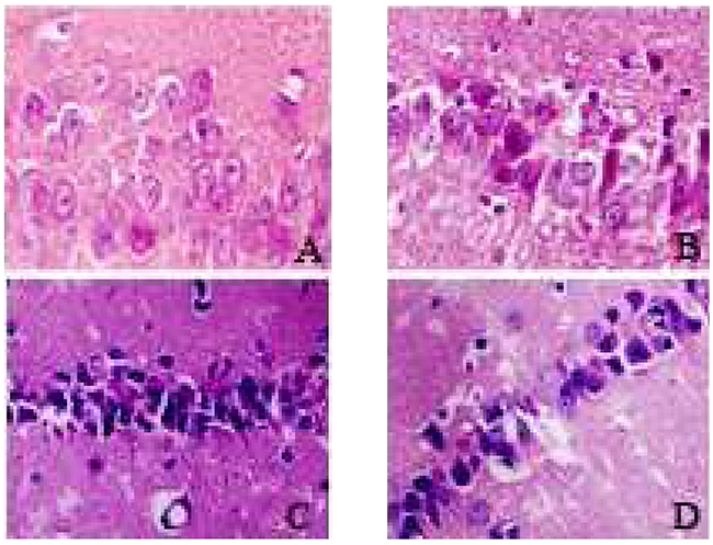 Hippocampus neurons of each group 24h after cerebral ischemia (HE staining, 400x).