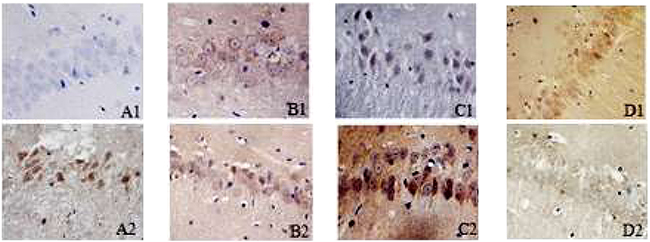 Positive expression of mTOR or beclin1 in the hippocampus of each group 24h after cerebral ischemia (immunohistochemical staining, 400x).