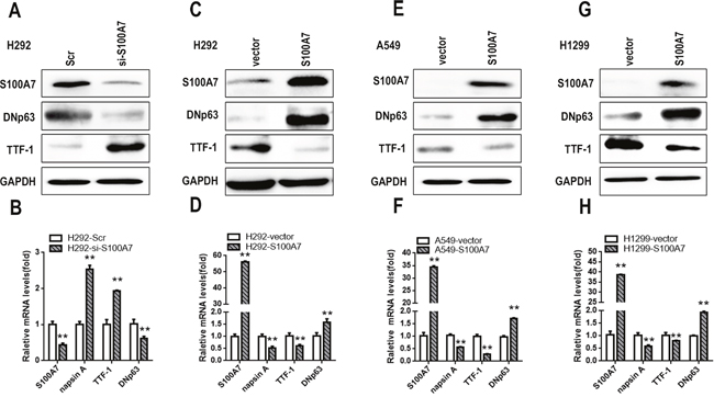 S100A7 promotes adenous to squamous transdifferentiation in lung cancer cells.