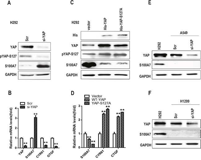 Knockdown of YAP promotes S100A7 expression in H292 cells.
