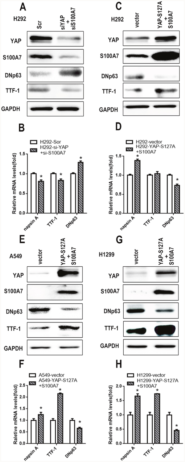 Ectopic expression of S100A7 partially rescues lung ADC to SCC transdifferentiation inhibited by YAP overexpression in lung cancer cells.