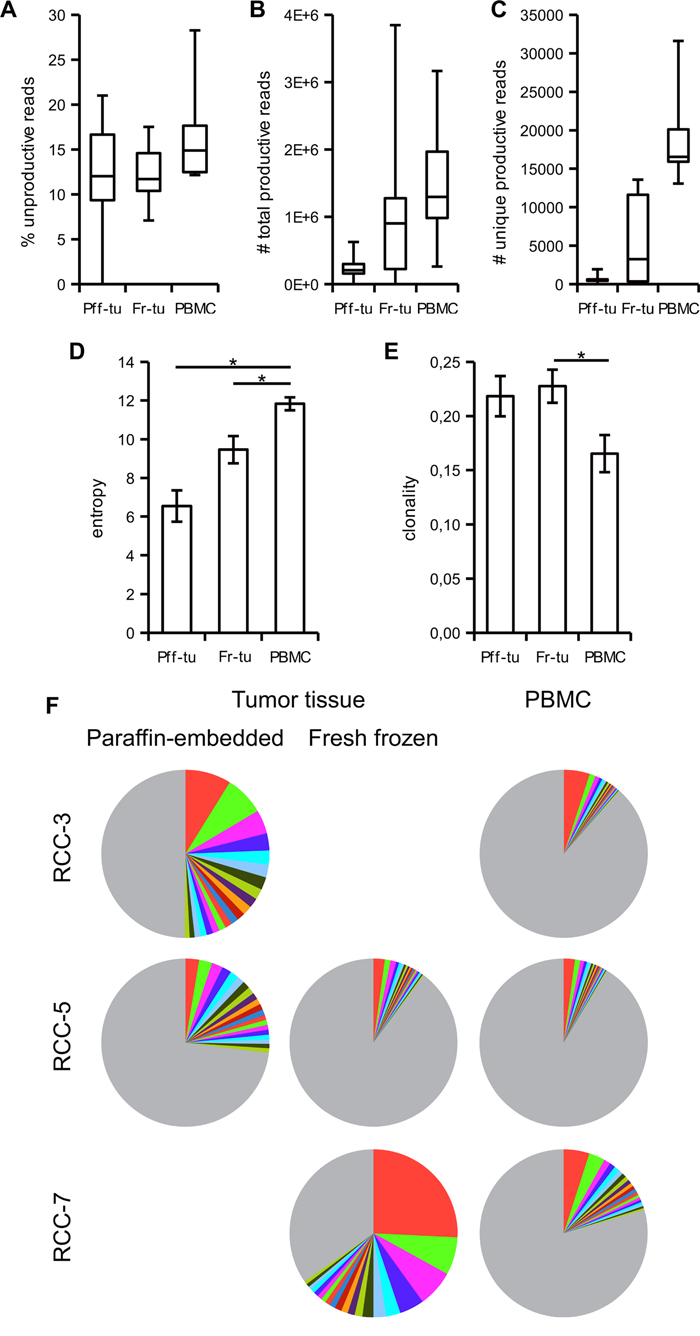 Tumor infiltrating lymphocytes have a more restricted TCR repertoire than blood resident T cells.