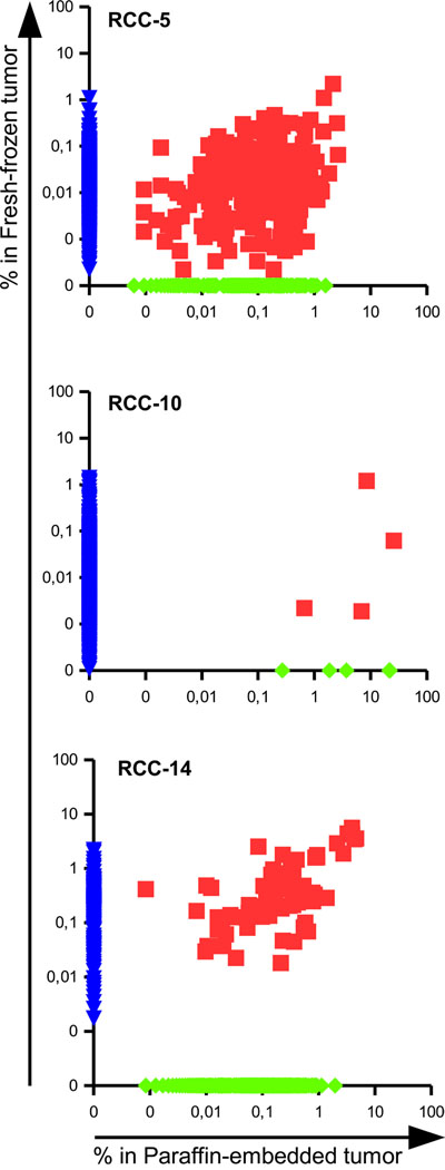 Presence of shared TCRs among different portion of the same tumor reveals a degree of spatial homogeneity in RCC.