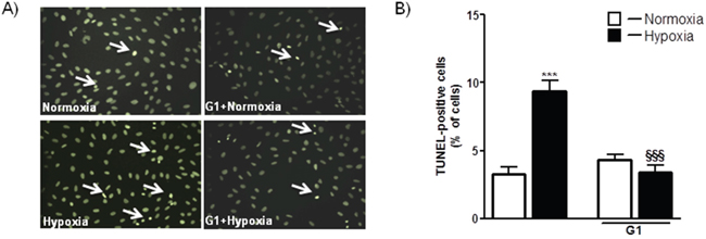 Effect of G1 on hypoxia-induced cell apoptosis.
