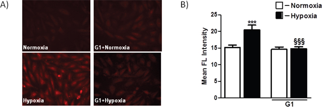 Effect of G1 on hypoxia-induced mitochondrial O2- production.