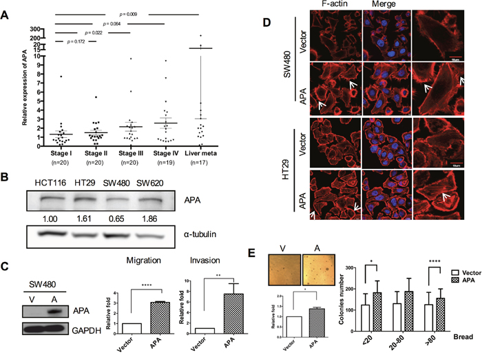 Aminopeptidase A expression increases with CRC progression and is associated with cell motility.