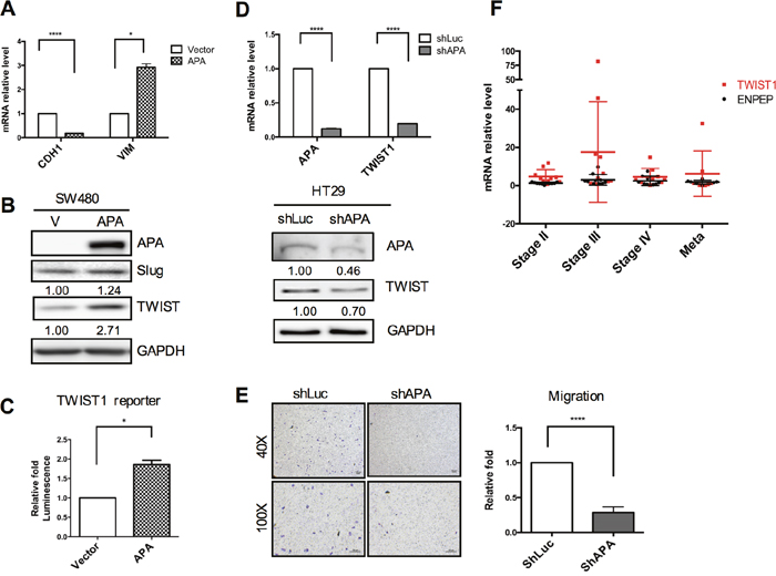 Positive correlation between APA and TWIST expression in CRC cell lines and patients.