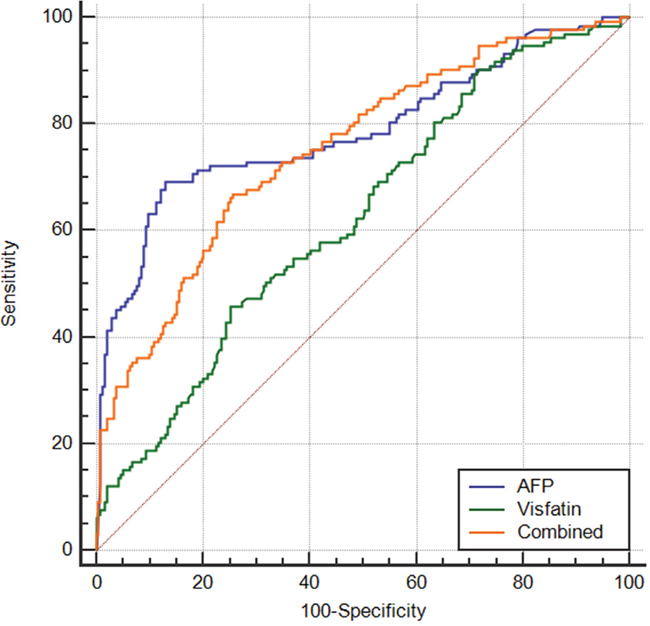 Receiver operating characteristic curve analysis for the predictive performance of serum visfatin for HCC.