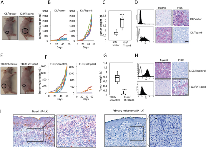 Tspan8 modulates melanoma growth in vivo and its expression correlates with downregulation of ILK phosphorylation.