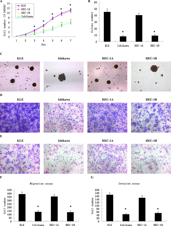 Different proliferation, migration and invasion abilities of 4 types of human endometrial cancer cell lines.