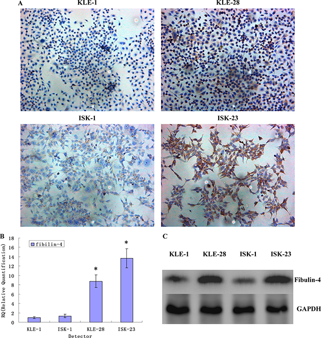 Fibulin-4 expressions in strongly invasive subclones and weakly invasive subclones.