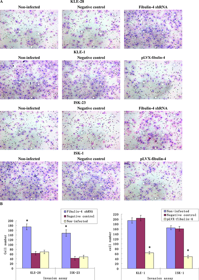 Effects of fibulin-4 on cell invasion abilities.