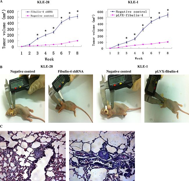 Effects of fibulin-4 on tumor growth and lung metastasis in nude mice.