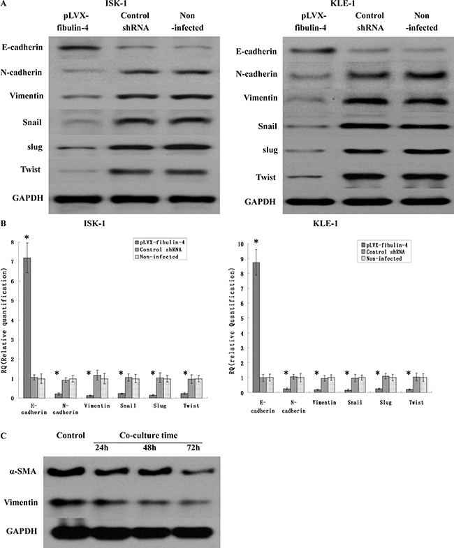 Effects of fibulin-4 over-expression on EMT genes correlated to tumor progression.