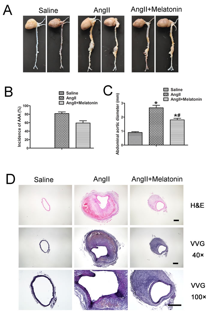 Melatonin attenuates AngII-induced AAA