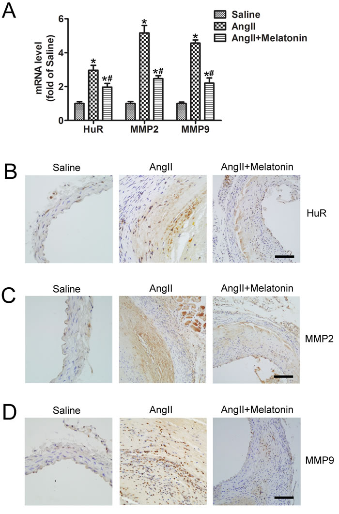 Melatonin suppresses HuR, MMP2 and MMP9 expression