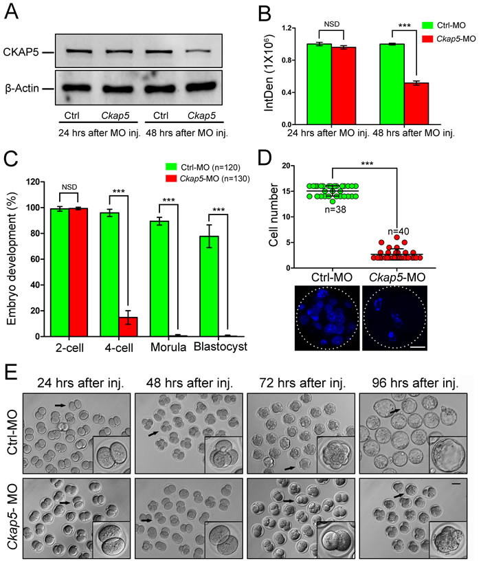 Knock-down of CKAP5 in the PN stage impairs embryonic development.