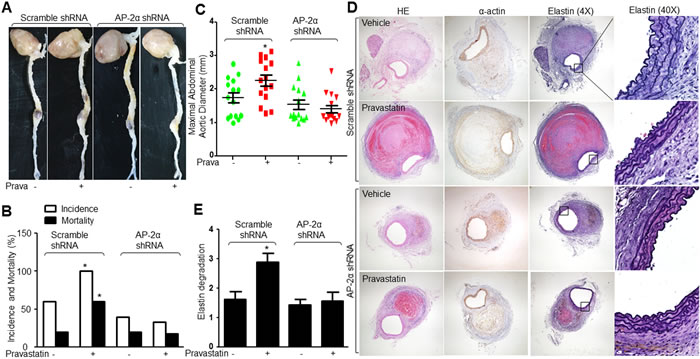Lentivirus-mediated gene knockdown of AP-2&#x3b1; abolishes the effects of pravastatin on AAA formation in