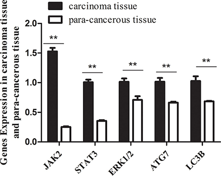 The mRNA levels of jak2, stat3, erk1/2, atg7, lc3b genes in carcinoma tissues are significantly lower than that in para-carcinoma tissues.