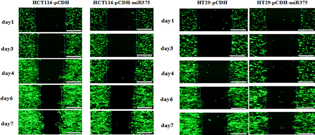 miR-375 had no effects on cell migration.