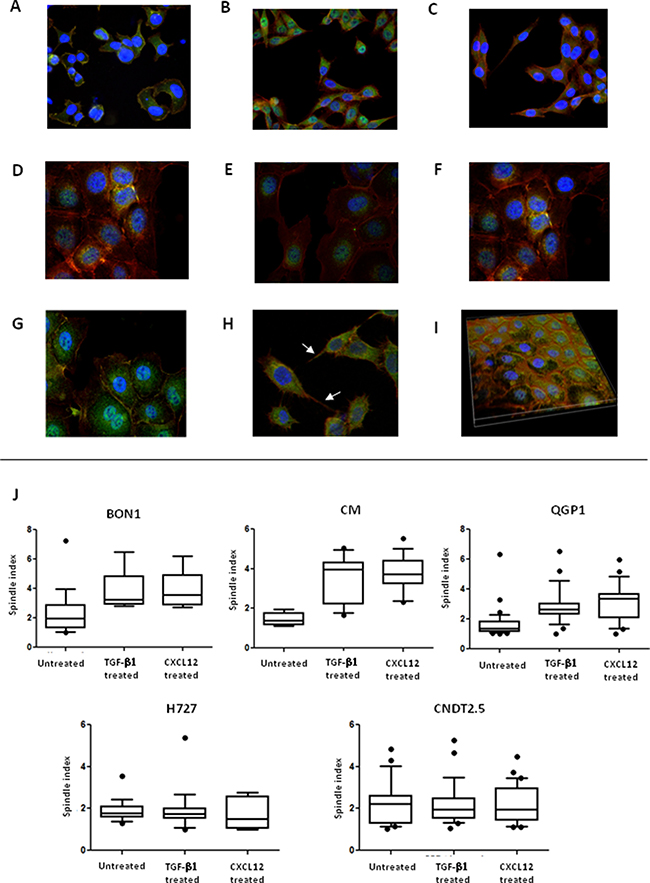 CXCL12 induces modifications in NET cell morphology.