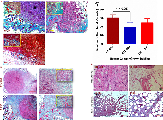 Diet-induced obesity promotes tumor angiogenic and metastatic potential.