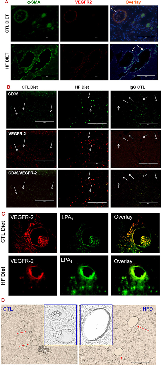 LPA/PKD-1 signaling in arteriogenic gene expression.