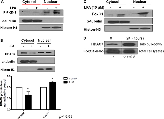 Sustained LPA/PKD-1 signaling may be involved in TAEC differentiation.