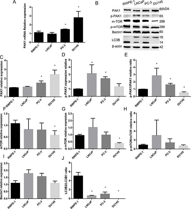 Expression of PAK1 mRNA and protein in patients with PCa and prostatic epithelial cells.