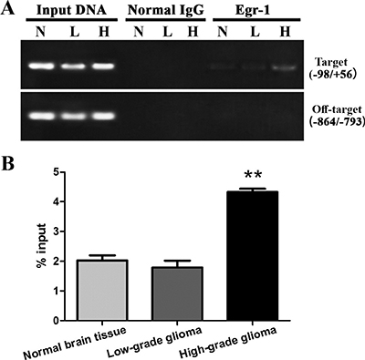 Egr-1 binding to GDNF gene promoter region II in human high-grade glioma tissue (H), low-grade glioma tissue (L), and normal brain tissue (N).