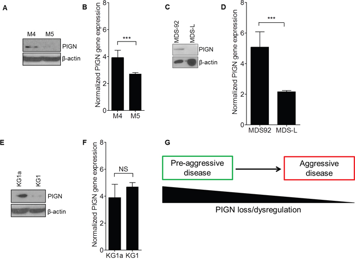 PIGN expression aberration was a marker of leukemic transformation and progression.