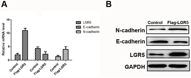 Expressions of LGR5, E-cadherin, and N-cadherin in Huh7 cell lines.