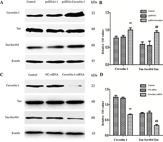 Effects of Caveolin-1 and on phosphorylated Tau protein.