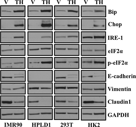 ER stress-induced EMT is neither cancer cell specific nor cell-type specific.