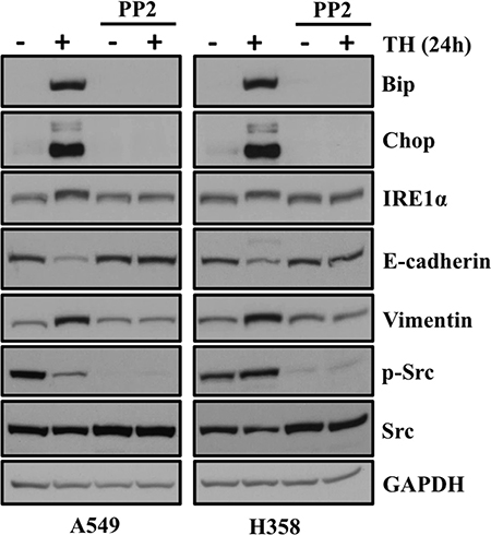 SRC kinase inhibitor PP2 blocks ER stress and EMT in lung adenocarcinoma cells treated with thapsigargin.